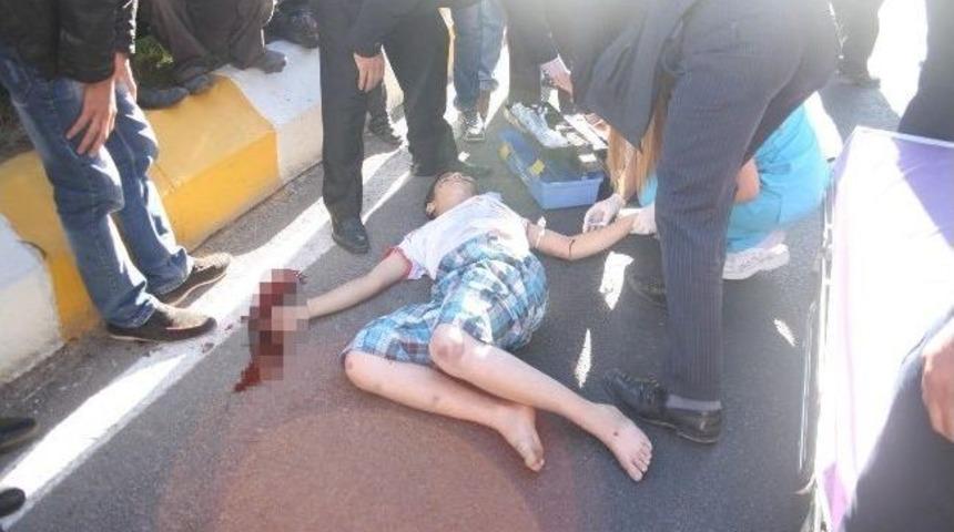 Yola Fırlayan &Ccedil;ocuğa Araba &Ccedil;arptı