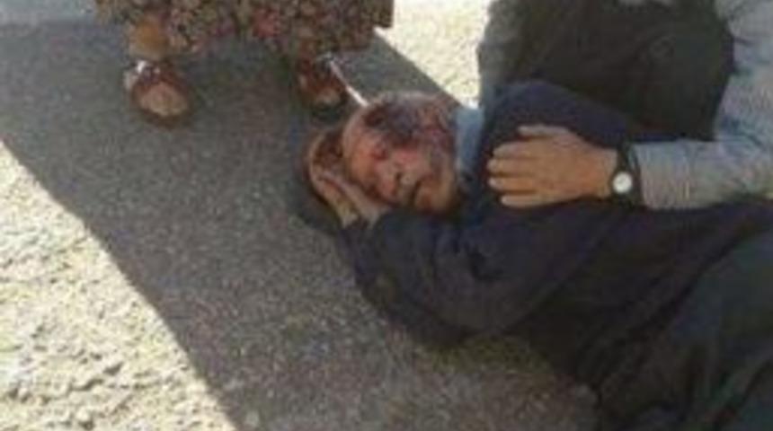 Kahta'da Trafik Kazaları: 4 Yaralı