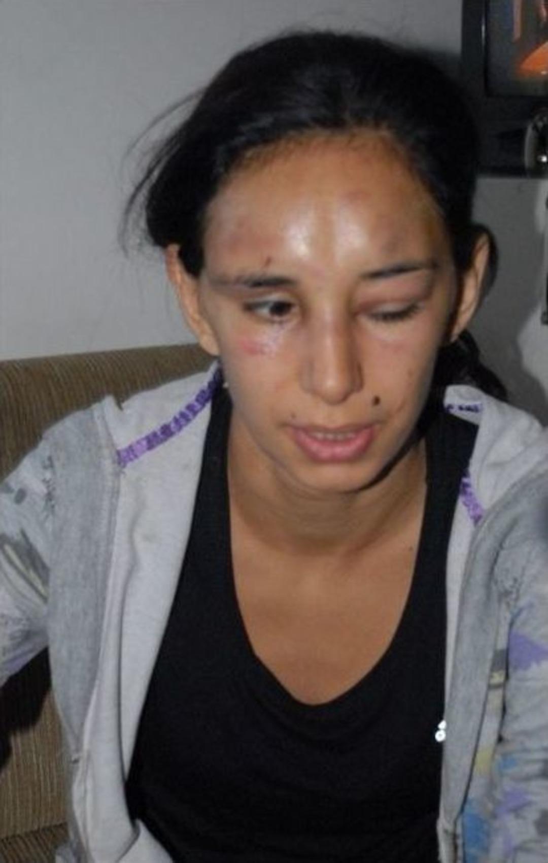 Kendisinden Ayrılmak İsteyen Eşini 3 G&uuml;n Boyunca D&ouml;vd&uuml;