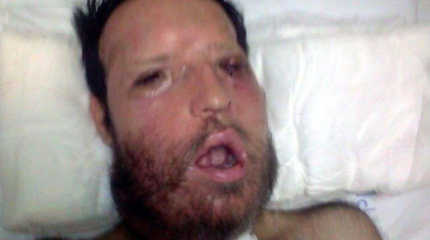 &Uuml;&ccedil; Ay Sonra Eve D&ouml;n&uuml;ş