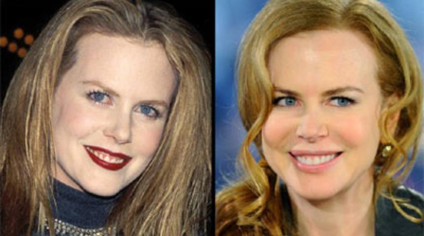 &Uuml;nl&uuml;lerin Sa&ccedil; Bakım Form&uuml;lleri