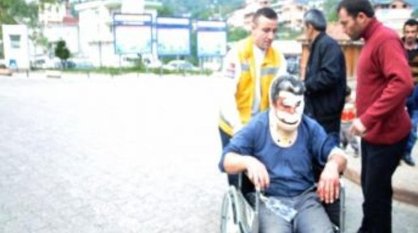 Ordu'da Patpat Kazası: 1 Yaralı