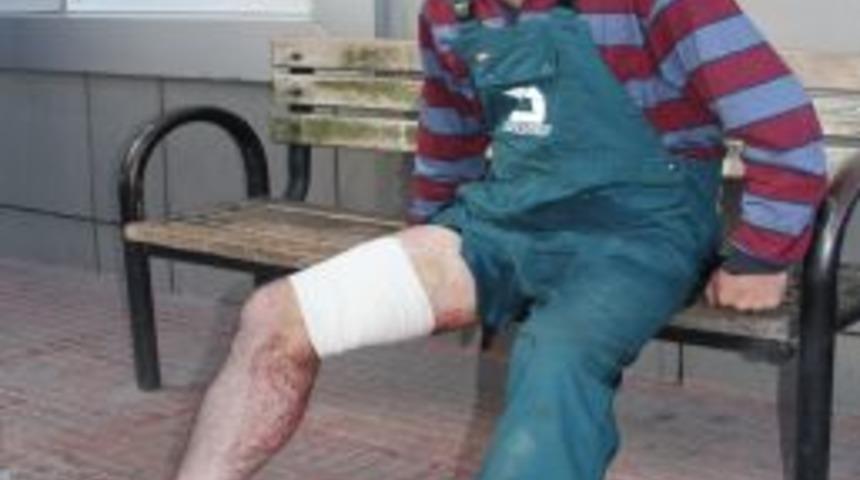 Acemiler Işbaşında, Kimi Kurban Keserken, Kimi Yardım Ederken Yaralandı