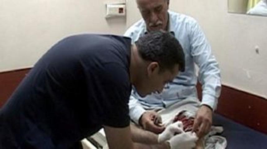 Siirt&rsquo;te Acemi Kasaplar Kendilerini Kesti