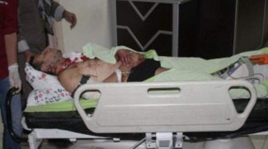 Keklik Avlarken Kendini Vurdu