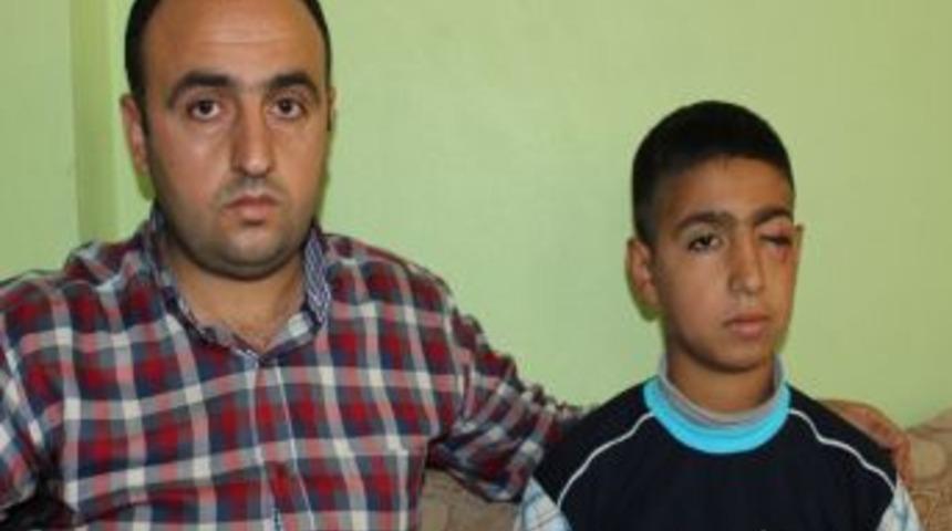 Atılan Maytap, 12 Yaşındaki &Ccedil;ocuğun G&ouml;z&uuml;ne Isabet Etti