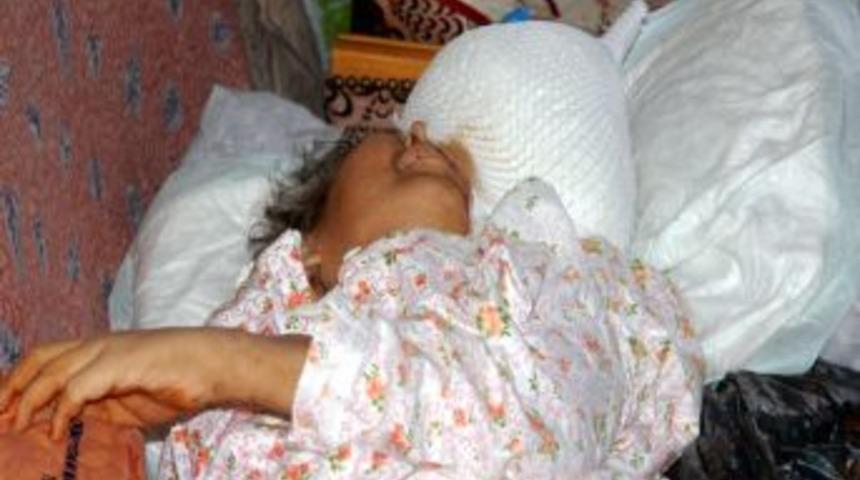 Y&uuml;z&uuml;ndeki 10 Kiloya Yakın Urla Yaşıyor