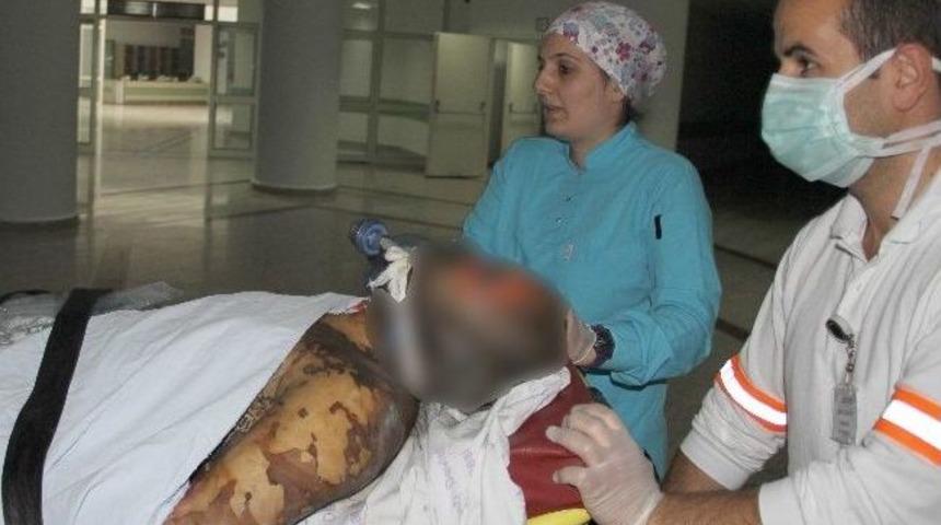 Emniyet &ouml;n&uuml;nde kendini yakan Yaşar Uyar &ouml;ld&uuml;