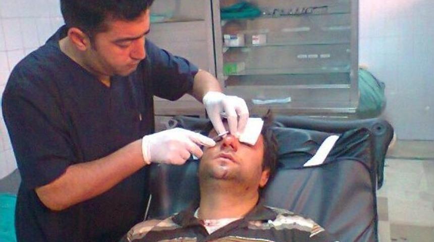 Okuldan Atıldı M&uuml;d&uuml;r Yardımcısının Burnunu Kırdı