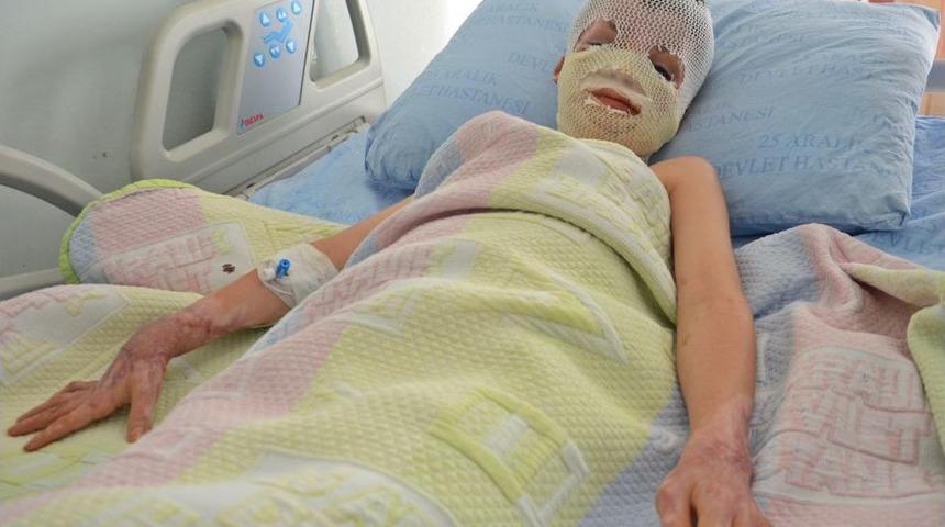 Y&uuml;z&uuml; Tamamen Yanan Suriyeli &Ccedil;ocuğun T&uuml;m Y&uuml;z Derisi Yenilendi