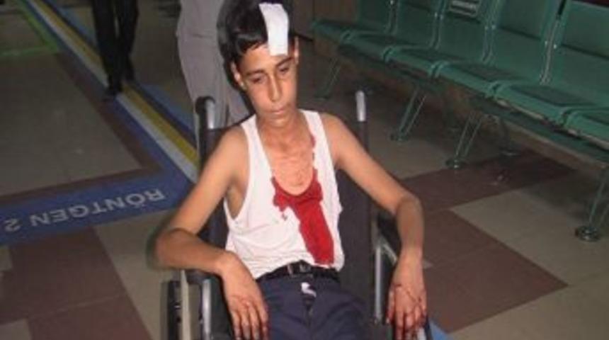 İnşaattan Kafasına Kalıp Tahtası D&uuml;şen &Ccedil;ocuk Yaralandı