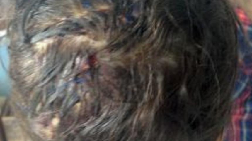 Manisa'da K&ouml;peğin Isırdığı &Ccedil;ocuğun Başına 60 Dikiş Atıldı