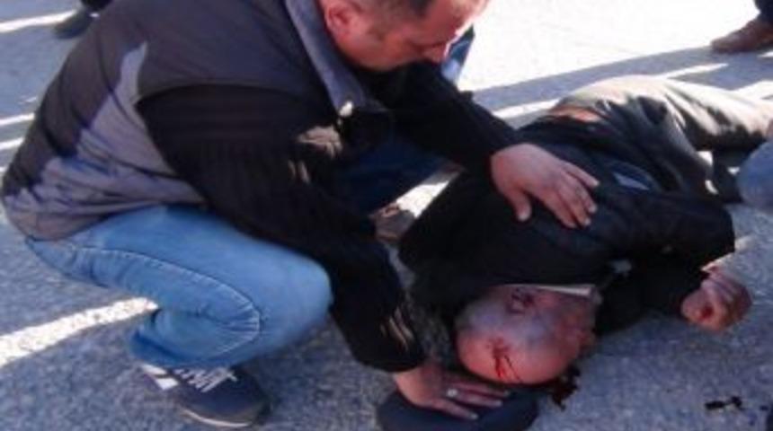 Otomobilin &Ccedil;arptığı Yaya Ağır Yaralandı