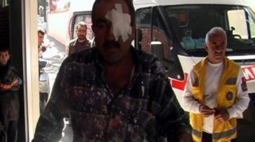 Boya Yaparken G&ouml;z&uuml;ne Cam Battı