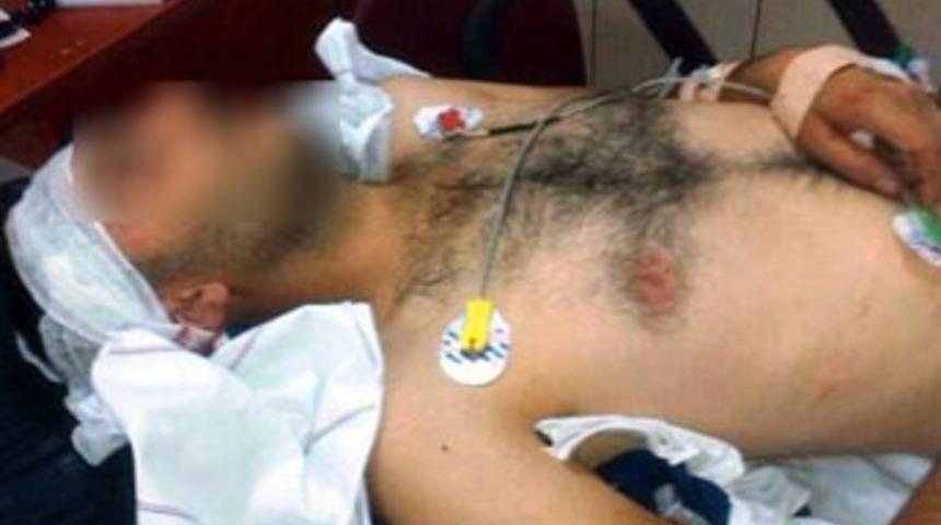 Ka&ccedil;ırmaya &ccedil;alıştığı kızın ağabeyi başından vurdu