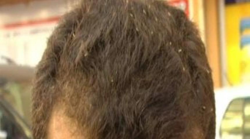 Yozgat’ı Sinekler İstila Etti