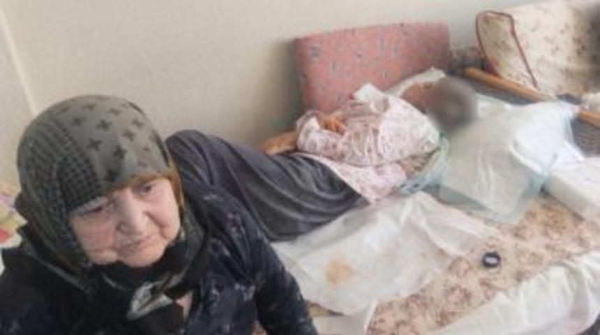 Y&uuml;z&uuml;nde 4.5 kiloluk ur &ccedil;ıkan kadın &ouml;ld&uuml;