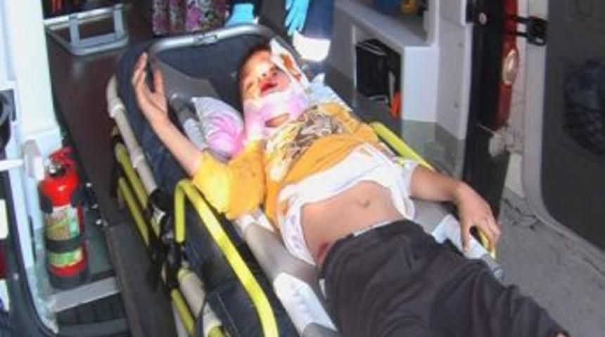 Otomobil &Ccedil;ocuğa &Ccedil;arptı: 1 Yaralı