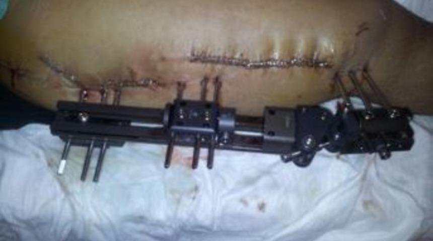 Sağlık Turizmine Elazığ&rsquo;dan Dev Atak