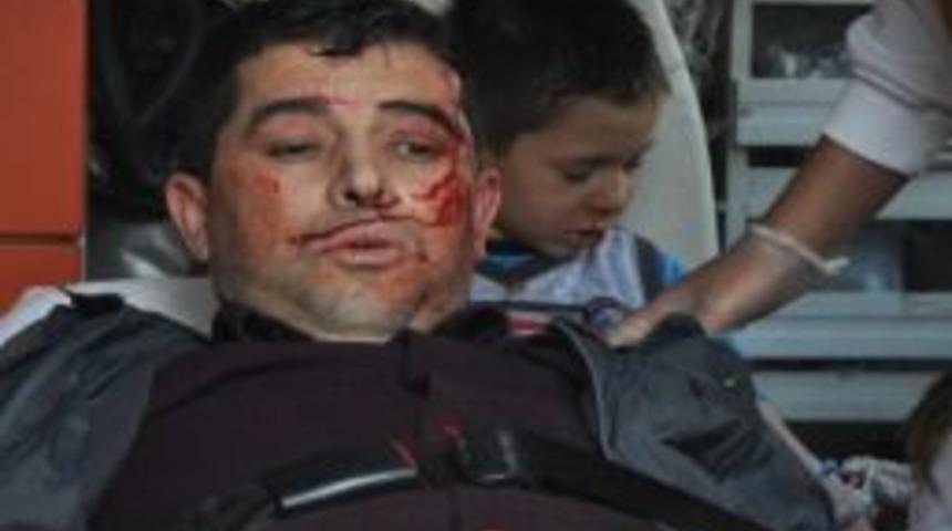 Motosikletin &Ccedil;arptığı 3 Kişi Yaralandı