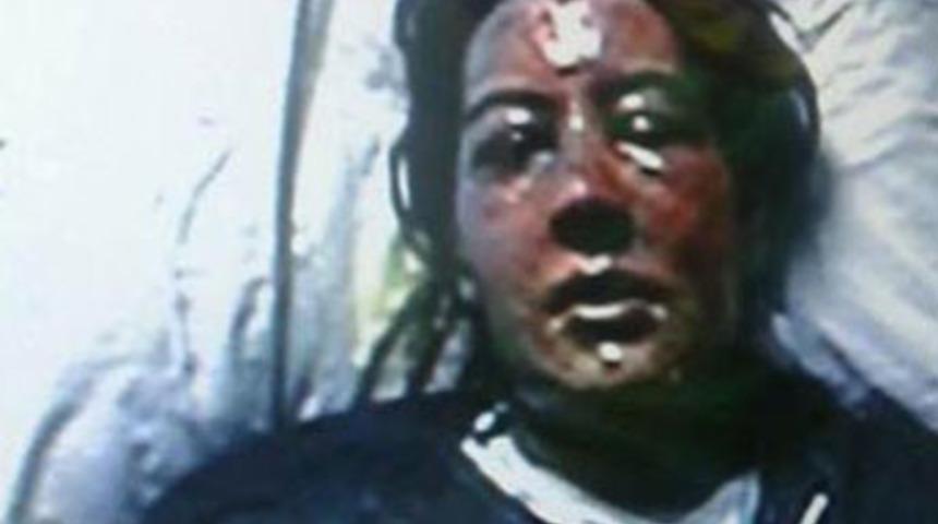 Uyuyan eşini kaynar su ile haşladı