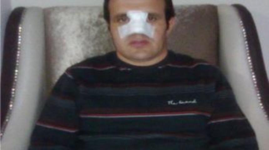 Kaza yapan s&uuml;r&uuml;c&uuml;ye lin&ccedil; girişimi