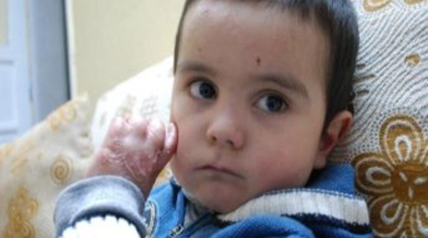 V&uuml;cutlarından s&uuml;rekli kan ve iltihap akıyor