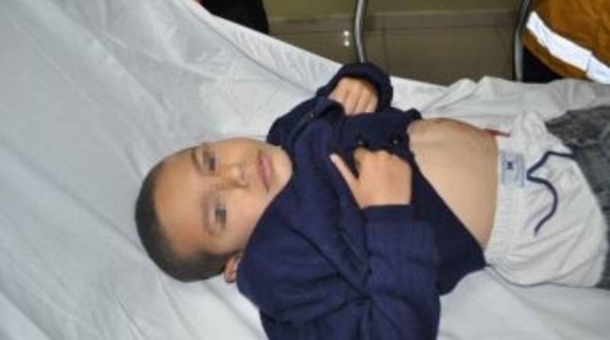 5 yaşındaki yeğenini 2 yerinden bı&ccedil;akladı