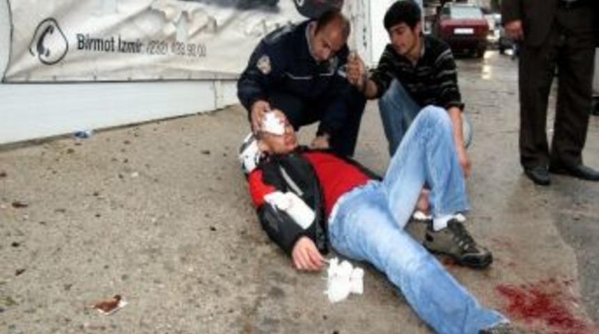 Polisin Yaralı Başında Şemsiyeli Nöbeti