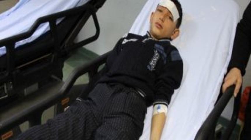 Maganda Kurşunu 11 Yaşındaki &Ccedil;ocuğu Kafasından Yaraladı