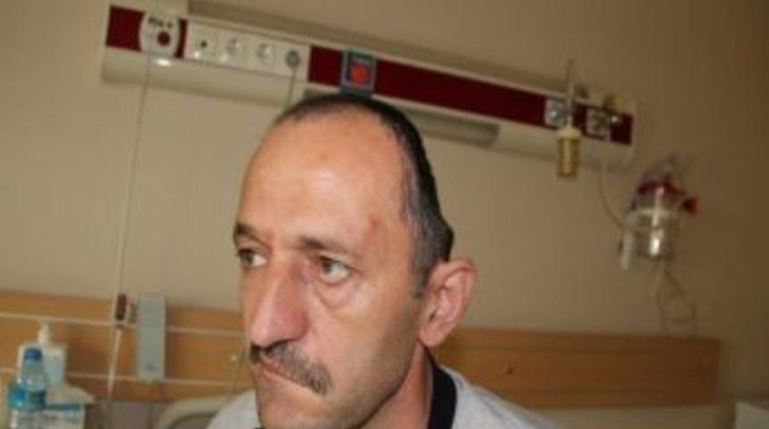 Yapay Kafatası İle Hayata D&ouml;nd&uuml;