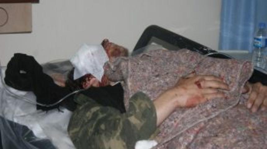 &Ccedil;atışmalarda Yaralanan 7 Kişi Tedavi İ&ccedil;in Kilis'e Getirildi