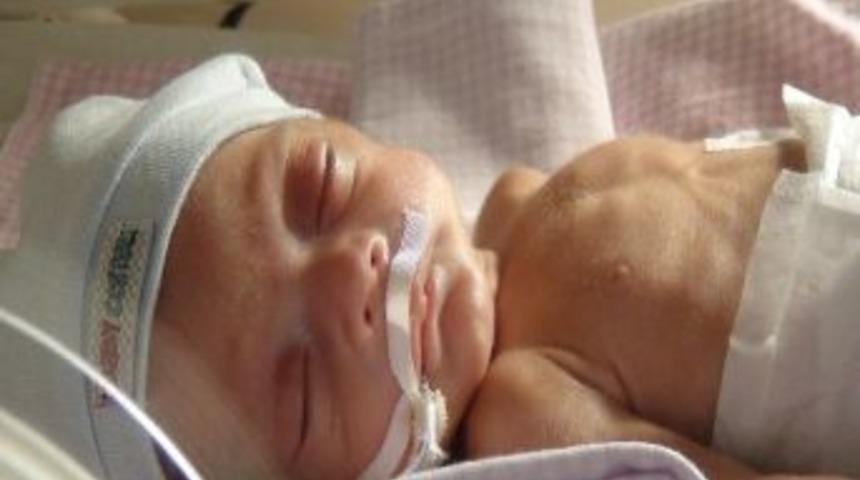 680 Gram Doğan Umut Bebek Bin 200 Grama Ulaştı