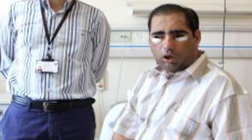 &Ccedil;ene Ve Dil Ile Birlikte, Y&uuml;z Nakli De Yapılan Salih &Uuml;sl&uuml;n, Sa&ccedil; Tıraşı Oldu