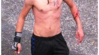 İzmir'de bir kişi bıçakla kendini yaraladı