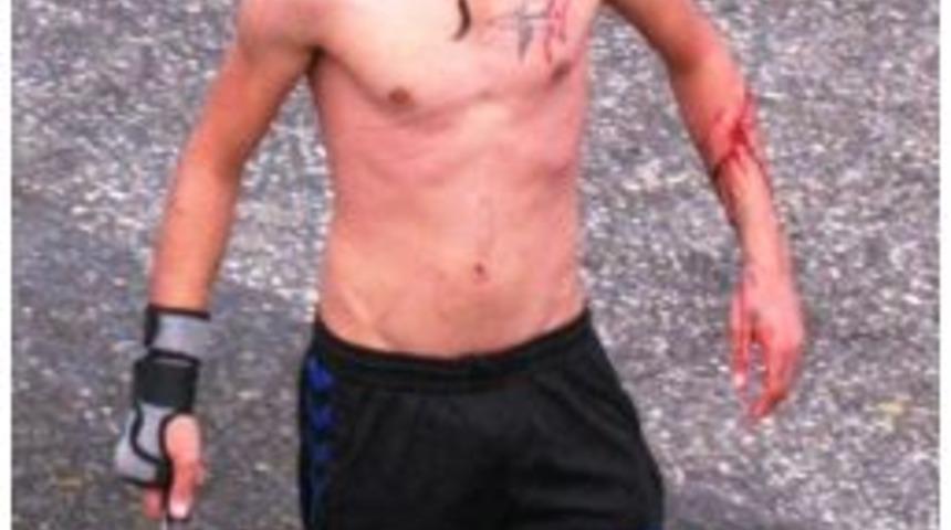 İzmir'de bir kişi bıçakla kendini yaraladı