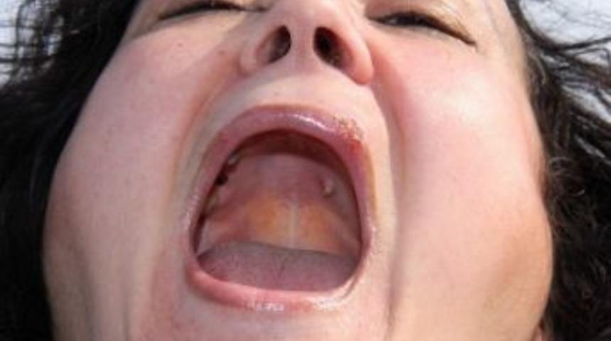 G&ouml;z&uuml;nde Unutulan Suni Damar, 18 Yıl Sonra Damağından &Ccedil;ıktı