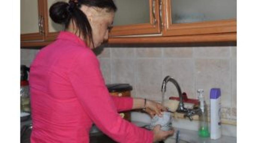 Perihan Dağlıoğlu, y&uuml;z nakli olmak istiyor