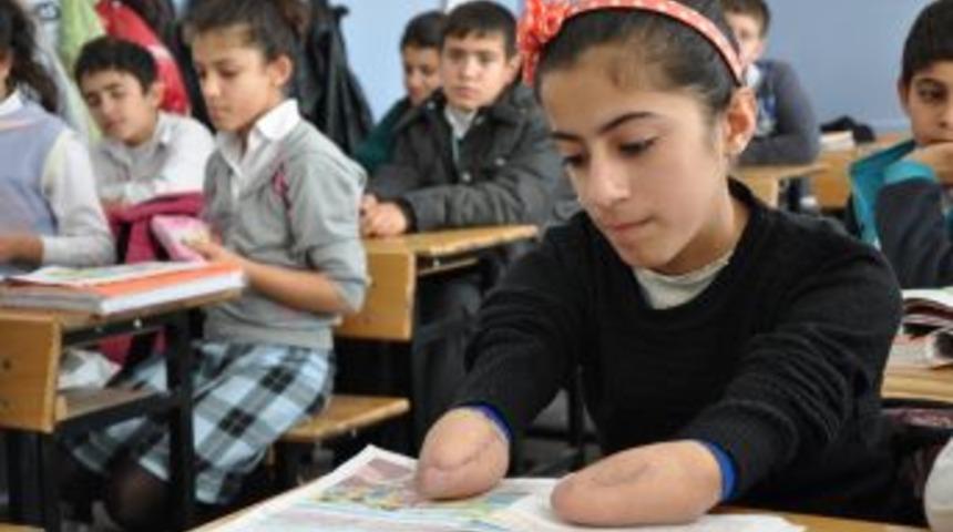 Protez Hayaliyle Yaşayan Hazal Umudunu Kesmiyor