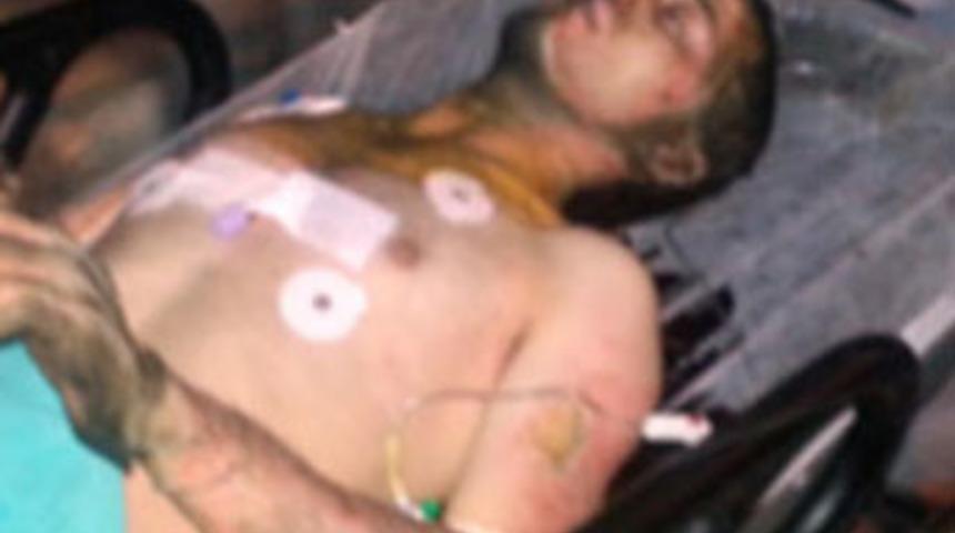 Sevgilisi konuşmayınca kendini yaktı