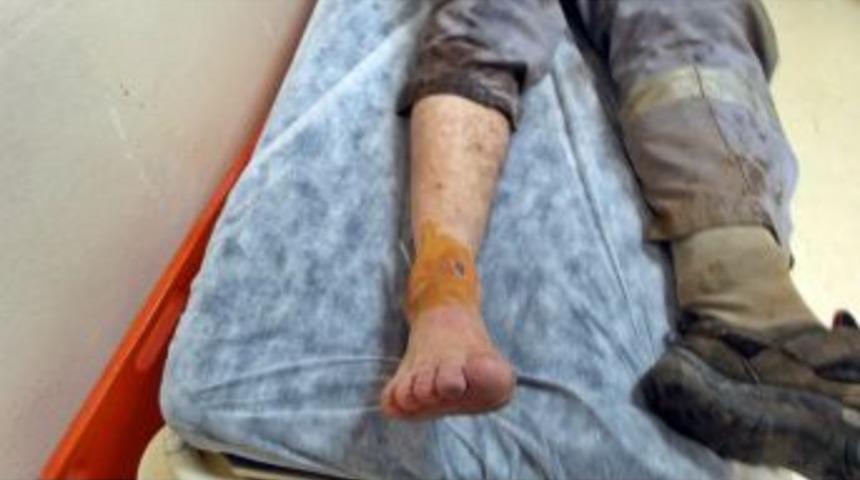 Hızlı Tren Inşaatında Ayağına 25 Santimetrelik &Ccedil;ivi Saplandı