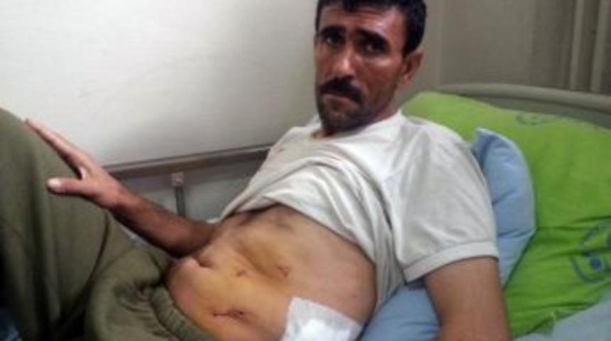 Siirt&rsquo;te B&ouml;brek Ameliyatında Devrim