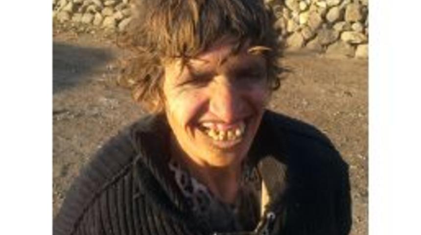 Ahırda Yaşayan Zihinsel Engelliye Devlet Sahip &Ccedil;ıktı