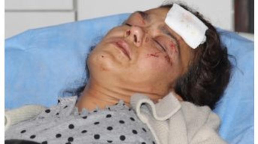 (&ouml;zel Haber) &ldquo;alkol Alma&rdquo; Dedi Kocası Bu Hale Getirdi