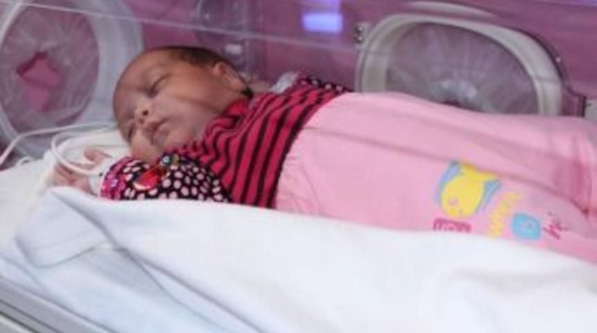 (&ouml;zel Haber) 715 Gram Doğan H&uuml;lya Bebek, G&ouml;z, Kalp Ve Akciğer Tedavisiyle Yaşama Tutundu