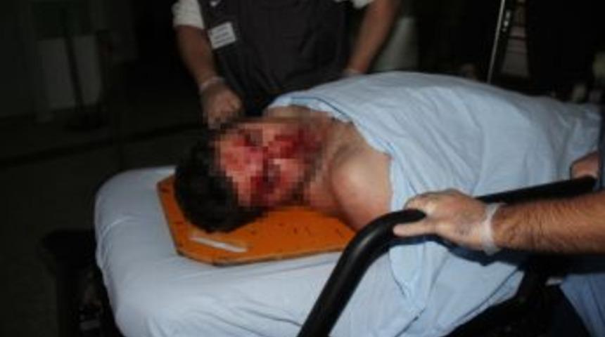 Kamyonun &Ccedil;arptığı Narkotik Polisi Yaralandı