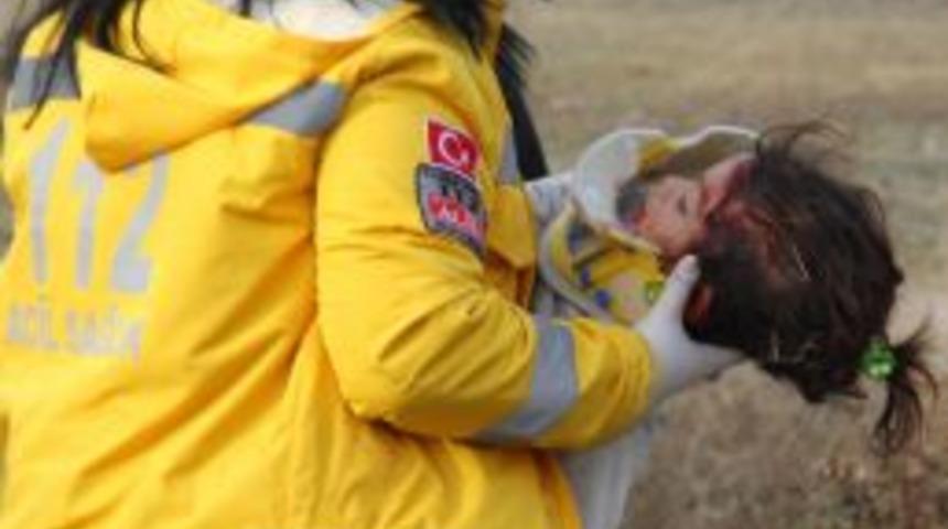 Trenin &Ccedil;arptığı &Ccedil;ocuk Ağır Yaralandı