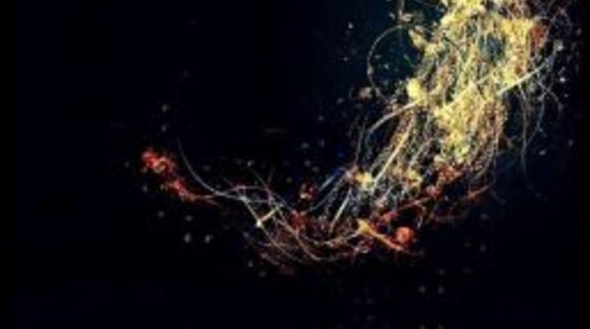 Fatih Erko&ccedil; Konserine Erteleme