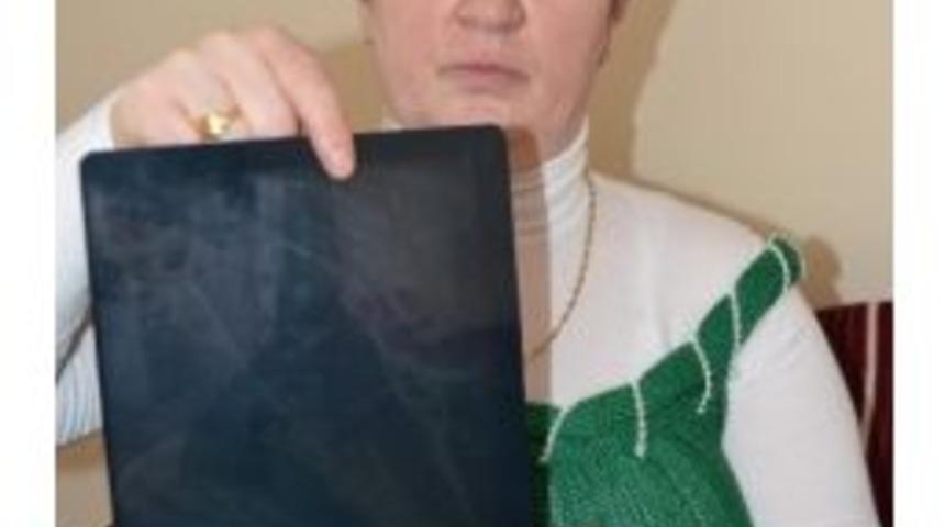 (&ouml;zel Haber) Karnında İğne Unutulan Kadının Davası 2 Yıldır S&uuml;r&uuml;yor