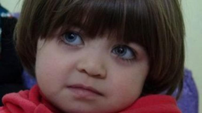 5 Yaşında Olmasına Rağmen 1.5 Yaşında G&ouml;r&uuml;n&uuml;yor